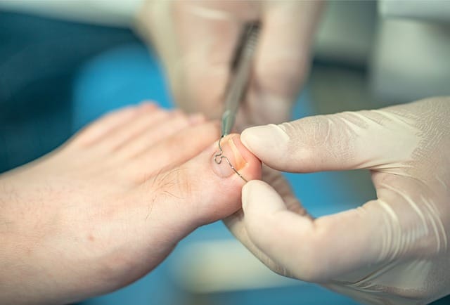 foot care, podiatry, feet, massage, clinic, hospital, orthonyxie, podiatry, podiatry, podiatry, podiatry, podiatry